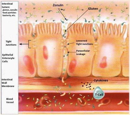 Zonulin-and-Gut-Integrity