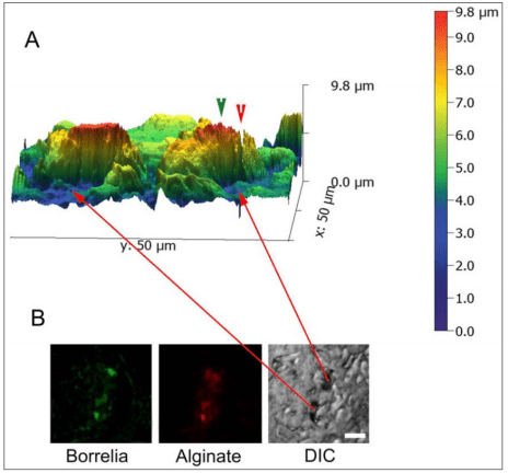 biofilm