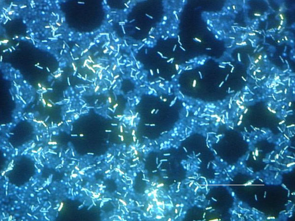 Polymicrobic biofilm grown on a stainless steel surface in a laboratory