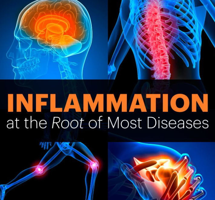 inflammation.png